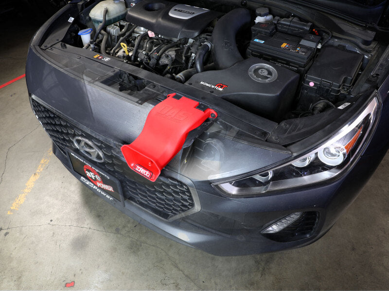 aFe Takeda 56-70005SR Dynamic Air Scoop, Red for 2018-2020 Hyundai Elantra GT 1.6L Turbo